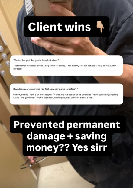 Form answer — learned the lesson before doing permanent damage, and skin looks good without ten products