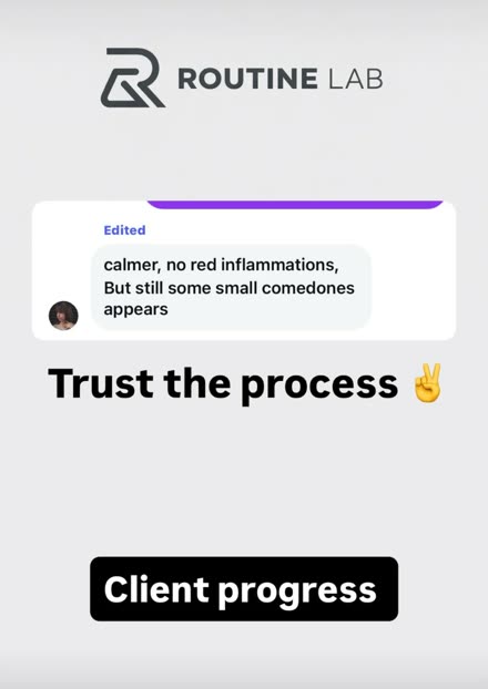 Client message — skin calmer with no red inflammation, some small comedones still appearing